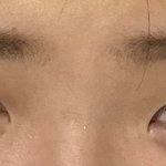 [댓글부탁해] 쌍수하면 이쁠눈인지 좀 봐죠요ㅜㅜ