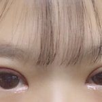 나 쌍수 <b>한지</b> 12일 됐는데