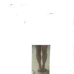 나 <b>종아리</b> 때문에 너무 스트레스 받아