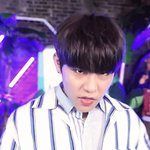 [박우진] 우진이 <b>자주</b> 붓는듯