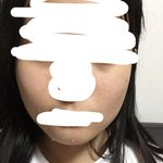 [드루와] 사진 있)나 보톡스 맞으면 <b>사각</b>턱 줄어들까.?
