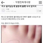 지금뿡뿡거리면서걷고잇는데인생망함