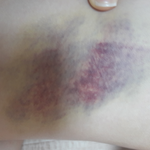 [조언부탁] 때리는남자친구 죽고싶습니다