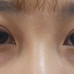 [피부관리] 대박 진짜진짜 모공&amp;주름 주름 고민인 사람만!!(광고X)