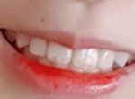 다들 <b>송곳니</b> 이렇게생겼어??