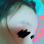 [댓글부탁해] 나 <b>성형</b>수술 한 것 같아?