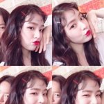 [댓글부탁해] 코<b>필러</b>하면 아이린처럼 됨?(사진 있음)