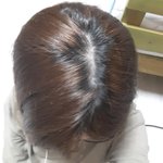 [댓글부탁해] 머리 자라는 <b>속도</b>