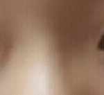 [댓글부탁해] 나 앞트임해야하나?ㅠㅠ