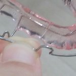 유지<b>장치</b>부러졌는데