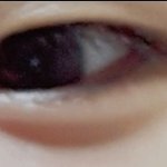 [댓글부탁해] 나 쌍수 해야될까?