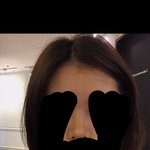 [드루와] 사진)<b>필러</b>후기