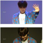 [박지훈] <b>지후</b>니 손바닥 괜찮아요