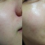 [화장품] <b>기초</b> 바꿨더니 ~