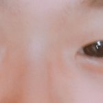 나 <b>정도</b>면 ㄹㅇ 쌍수 성공아님?