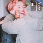 와ㅅㅂ나 <b>좁쌀</b> 여드름 박멸함