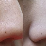 혐오스런 코 <b>해방</b>