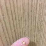 [혐ㅇ] 나 <b>편도</b>결석 개심한데 볼사람