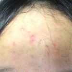 [조언부탁해] 약혐)얘들아 나 <b>이마</b> 여드름 말야