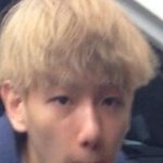 [EXO] 백현이 <b>필러</b>맞았냐