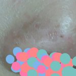 코<b>각질</b>어케없앰 쫌심각함<b>각질</b>__
