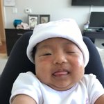 육아는 산너머 산?<내아기 태열을잡자 아기 여드름 편>