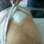 [꼭봐주세요] !!부산 요양병원 옴<b>전염</b>!!