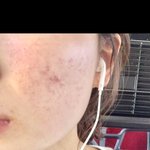 (사진+)돈 안들이고 피부 좋아지는 방법 알려드림