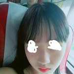 [조언부탁해] 피부과 가서 여드름 짰는데 원래 이래?ㅠㅠ