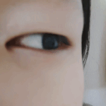 [댓글부탁해] 나 무쌍같음 <b>속쌍</b>같음