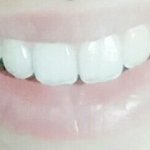 [댓글부탁해] 송곳니 나처럼 <b>뾰족</b>한 사람?ㅠㅠ(사진있음)