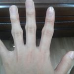 [엔터톡] 손 <b>뼈</b><b>소리</b>내면 이렇게돼