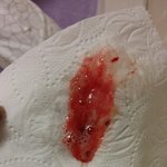 안아키 피해자 엄마 2. 피 토하기 전까지, 나도 안아키의 시작은...