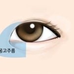 몽고주름 잇는데 <b>쌍액</b> 하는 사람들 들어와바