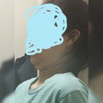 [드루와] ㅅ1발;;;;<b>턱살</b> 죽고싶다ㅏ