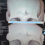 [도와주세요] [데이트폭력] 술그만 마시고 집에 가자고했다가 맞았어요