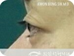 [댓글부탁해] 나보다 극혐으로 생긴사람 없을걸