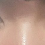 [이것좀봐줘] 남자 눈교+쌍수 1년차 평가좀