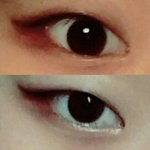 [드루와] 절개 쌍수+안검하수+<b>듀얼</b>트임후기 쓰고갈께!