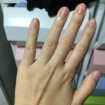 [방탈죄송] <b>힘줄</b>에 염증나셨던 분 도와주세요ㅠㅜ