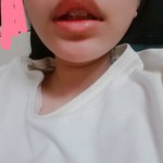 [댓글부탁해] <b>치아</b> 딱딱하면 이렇게 되는데
