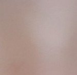 나 쌍수 망한거야?