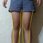 [댓글부탁해] 다리모양 때문에 스트레스야