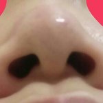 [조언부탁해] (혐주의)코 때문에 스트레스인데