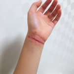[ㅋㅋㅋㅋㅋ] 시험망해서ㅎ ㅎ 상처추반