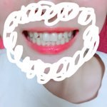 [댓글부탁해] 치아모양이 안 예뻐.. 승무원면접 볼 때 <b>지장</b>있을까??