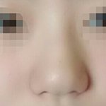 이런 코는 무슨성형이나 <b>시술</b> 해야해?