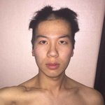 [댓글부탁해] 티눈 떨어질때 <b>쾌감</b>쩔지않?