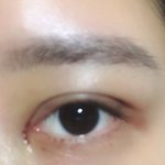 추가++) 오늘 쌍수했는데 겁나 잘됨