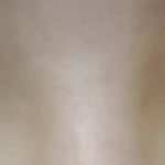 [조언부탁해] 얘들아 나 쌍수할건데 <b>헬프</b>!!!!